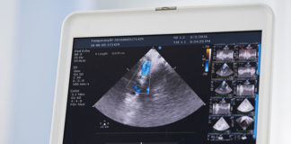 Sprzęt echokardiograficzny pozwala wykryć liczne wady serca