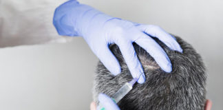 Transplantacja włosów - czy jest sens poddawania się takiemu zabiegowi?
